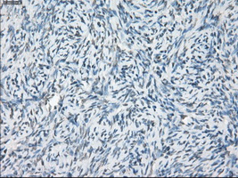 LTA4H / LTA4 Antibody - IHC of paraffin-embedded Ovary tissue using anti-LTA4H mouse monoclonal antibody. (Dilution 1:50).