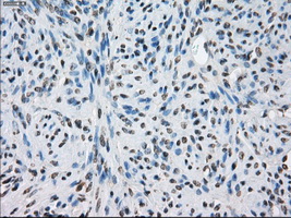 LTA4H / LTA4 Antibody - IHC of paraffin-embedded endometrium tissue using anti-LTA4H mouse monoclonal antibody. (Dilution 1:50).