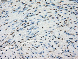 LTA4H / LTA4 Antibody - IHC of paraffin-embedded prostate tissue using anti-LTA4H mouse monoclonal antibody. (Dilution 1:50).