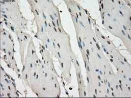 LTA4H / LTA4 Antibody - IHC of paraffin-embedded bladder tissue using anti-LTA4H mouse monoclonal antibody. (Dilution 1:50).