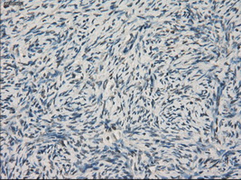 LTA4H / LTA4 Antibody - IHC of paraffin-embedded Ovary tissue using anti-LTA4H mouse monoclonal antibody. (Dilution 1:50).