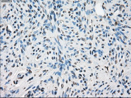 LTA4H / LTA4 Antibody - IHC of paraffin-embedded endometrium tissue using anti-LTA4H mouse monoclonal antibody. (Dilution 1:50).