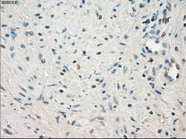 LTA4H / LTA4 Antibody - IHC of paraffin-embedded prostate tissue using anti-LTA4H mouse monoclonal antibody. (Dilution 1:50).