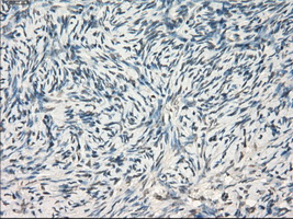 LTA4H / LTA4 Antibody - IHC of paraffin-embedded Ovary tissue using anti-LTA4H mouse monoclonal antibody. (Dilution 1:50).