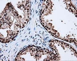 LTA4H / LTA4 Antibody - IHC of paraffin-embedded prostate tissue using anti-LTA4H mouse monoclonal antibody. (Dilution 1:50).