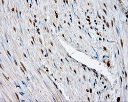 LTA4H / LTA4 Antibody - Immunohistochemical staining of paraffin-embedded colon tissue using anti-LTA4H mouse monoclonal antibody. (Dilution 1:50).