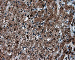 LTA4H / LTA4 Antibody - Immunohistochemical staining of paraffin-embedded liver tissue using anti-LTA4H mouse monoclonal antibody. (Dilution 1:50).
