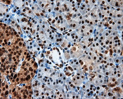 LTA4H / LTA4 Antibody - Immunohistochemical staining of paraffin-embedded pancreas tissue using anti-LTA4H mouse monoclonal antibody. (Dilution 1:50).