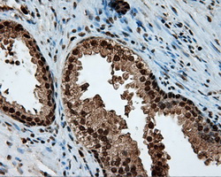 LTA4H / LTA4 Antibody - Immunohistochemical staining of paraffin-embedded prostate tissue using anti-LTA4H mouse monoclonal antibody. (Dilution 1:50).
