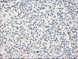 LTA4H / LTA4 Antibody - IHC of paraffin-embedded endometrium tissue using anti-LTA4H mouse monoclonal antibody. (Dilution 1:50).