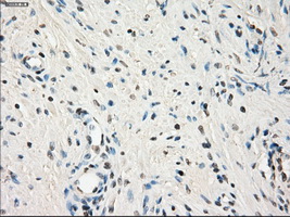 LTA4H / LTA4 Antibody - IHC of paraffin-embedded prostate tissue using anti-LTA4H mouse monoclonal antibody. (Dilution 1:50).
