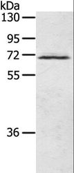 LTA4H / LTA4 Antibody - Western blot analysis of Human fetal brain tissue, using LTA4H Polyclonal Antibody at dilution of 1:500.