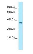 LTB4R2 / BLT2 Antibody - LTB4R2 / BLT2 antibody Western Blot of 721_B.  This image was taken for the unconjugated form of this product. Other forms have not been tested.