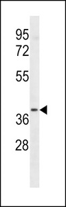 LTB4R2 / BLT2 Antibody - LTB4R2 Antibody western blot of A549 cell line lysates (35 ug/lane). The LTB4R2 antibody detected the LTB4R2 protein (arrow).