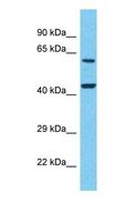 LTB4R2 / BLT2 Antibody - Western blot of LTB4R2 Antibody with human Placenta lysate.  This image was taken for the unconjugated form of this product. Other forms have not been tested.