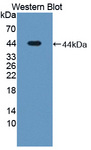 LTBP1 / LTBP-1 Antibody - Western blot of LTBP1 / LTBP-1 antibody.