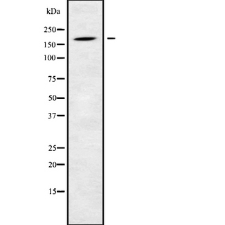 LTBP1 / LTBP-1 Antibody - Western blot analysis of LTBP1 using HeLa whole cells lysates