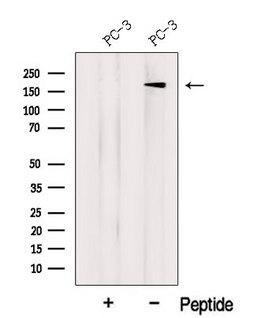 LTBP2 Antibody - Western blot analysis of extracts of PC-3 cells using LTBP2 antibody. The lane on the left was treated with blocking peptide.
