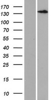 LTBP3 / LTBP-3 Protein - Western validation with an anti-DDK antibody * L: Control HEK293 lysate R: Over-expression lysate