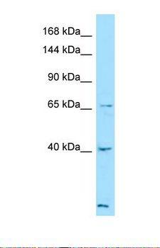 LTBP4 Antibody - Western blot of Human ACHN. LTBP4 antibody dilution 1.0 ug/ml.  This image was taken for the unconjugated form of this product. Other forms have not been tested.