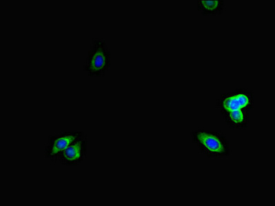 LTBP4 Antibody - Immunofluorescent analysis of HepG2 cells diluted at 1:100 and Alexa Fluor 488-congugated AffiniPure Goat Anti-Rabbit IgG(H+L)
