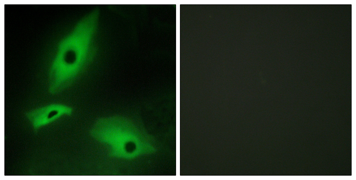 LTBR Antibody - Immunofluorescence analysis of HeLa cells, using LTBR Antibody. The picture on the right is blocked with the synthesized peptide.