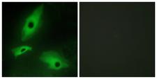LTBR Antibody - Immunofluorescence analysis of HeLa cells, using LTBR Antibody. The picture on the right is blocked with the synthesized peptide.