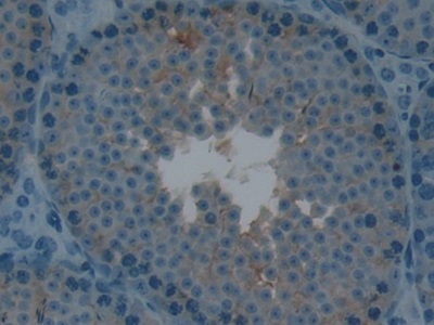 LTBR Antibody - Western Blot; Sample: Recombinant LTbR, Mouse