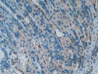 LTBR Antibody - Western Blot; Sample: Mouse Thymus Tissue.