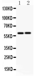 LTBR Antibody - Anti-LTBR antibody, Western blotting All lanes: Anti LTBR at 0.5ug/ml Lane 1: HELA Whole Cell Lysate at 40ugLane 2: A549 Whole Cell Lysate at 40ugPredicted bind size: 47KD Observed bind size: 60KD