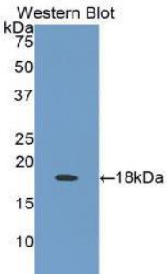 LTBR Antibody - Western blot of recombinant LTBR.  This image was taken for the unconjugated form of this product. Other forms have not been tested.