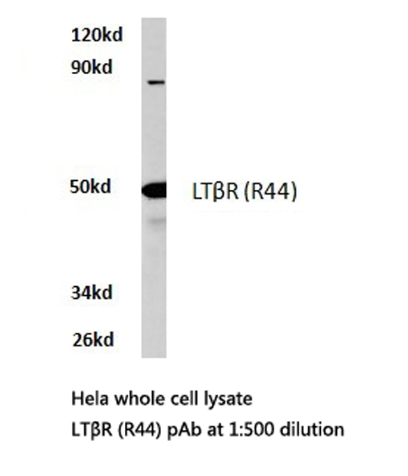 LTBR Antibody - Western blot of LTR (R44) pAb in extracts from HeLa cells.