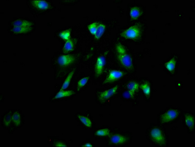 LTBR Antibody - Immunofluorescence staining of Hela cells diluted at 1:60,counter-stained with DAPI. The cells were fixed in 4% formaldehyde, permeabilized using 0.2% Triton X-100 and blocked in 10% normal Goat Serum. The cells were then incubated with the antibody overnight at 4°C.The Secondary antibody was Alexa Fluor 488-congugated AffiniPure Goat Anti-Rabbit IgG (H+L).