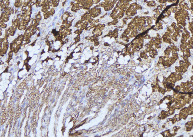 LTBR Antibody - 1:100 staining human gastric tissue by IHC-P. The sample was formaldehyde fixed and a heat mediated antigen retrieval step in citrate buffer was performed. The sample was then blocked and incubated with the antibody for 1.5 hours at 22°C. An HRP conjugated goat anti-rabbit antibody was used as the secondary.