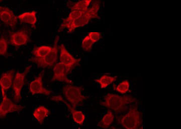 LTBR Antibody - Staining HeLa cells by IF/ICC. The samples were fixed with PFA and permeabilized in 0.1% Triton X-100, then blocked in 10% serum for 45 min at 25°C. The primary antibody was diluted at 1:200 and incubated with the sample for 1 hour at 37°C. An Alexa Fluor 594 conjugated goat anti-rabbit IgG (H+L) Ab, diluted at 1/600, was used as the secondary antibody.