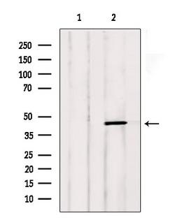 LTBR Antibody - Western blot analysis of extracts of mouse carcinoma using LTBR antibody. Lane 1 was treated with the blocking peptide.