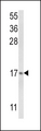 LTC4S / LTC4 Synthase Antibody - Western blot of LTC4S Antibody in NCI-H460 cell line lysates (35 ug/lane). LTC4S (arrow) was detected using the purified antibody.(2 ug/ml)