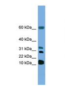 LTC4S / LTC4 Synthase Antibody - LTC4S antibody Western blot of HepG2 Cell lysate. Antibody concentration 1 ug/ml. This image was taken for the unconjugated form of this product. Other forms have not been tested.