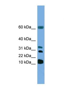LTC4S / LTC4 Synthase Antibody - LTC4S antibody Western blot of HepG2 Cell lysate. Antibody concentration 1 ug/ml. This image was taken for the unconjugated form of this product. Other forms have not been tested.