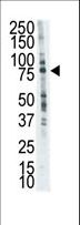 LTK Antibody - The anti-LTK antibody is used in Western blot to detect LTK in placenta cell lysate.