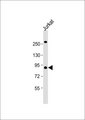 LTK Antibody - Anti-LTK Antibody at 1:1000 dilution + Jurkat whole cell lysate Lysates/proteins at 20 ug per lane. Secondary Goat Anti-Rabbit IgG, (H+L), Peroxidase conjugated at 1:10000 dilution. Predicted band size: 92 kDa. Blocking/Dilution buffer: 5% NFDM/TBST.