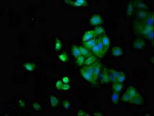 LTK Antibody - Immunofluorescence staining of HepG2 cells at a dilution of 1:66, counter-stained with DAPI. The cells were fixed in 4% formaldehyde, permeabilized using 0.2% Triton X-100 and blocked in 10% normal Goat Serum. The cells were then incubated with the antibody overnight at 4 °C.The secondary antibody was Alexa Fluor 488-congugated AffiniPure Goat Anti-Rabbit IgG (H+L) .