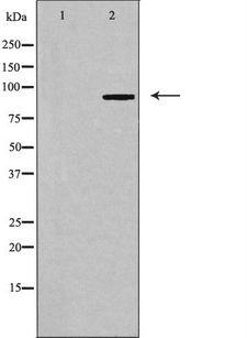 LTK Antibody - Western blot analysis of extracts of Jurkat cells using LTK antibody. The lane on the left is treated with the antigen-specific peptide.