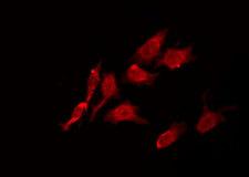 LTK Antibody - Staining HeLa cells by IF/ICC. The samples were fixed with PFA and permeabilized in 0.1% Triton X-100, then blocked in 10% serum for 45 min at 25°C. The primary antibody was diluted at 1:200 and incubated with the sample for 1 hour at 37°C. An Alexa Fluor 594 conjugated goat anti-rabbit IgG (H+L) Ab, diluted at 1/600, was used as the secondary antibody.