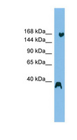 LTN1 / RNF160 Antibody - LTN1 / RNF160 antibody Western blot of HepG2 cell lysate. This image was taken for the unconjugated form of this product. Other forms have not been tested.