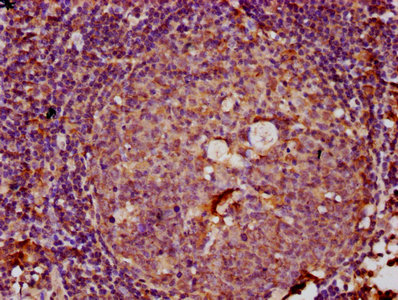 LTN1 / RNF160 Antibody - Immunohistochemistry Dilution at 1:100 and staining in paraffin-embedded human tonsil tissue performed on a Leica BondTM system. After dewaxing and hydration, antigen retrieval was mediated by high pressure in a citrate buffer (pH 6.0). Section was blocked with 10% normal Goat serum 30min at RT. Then primary antibody (1% BSA) was incubated at 4°C overnight. The primary is detected by a biotinylated Secondary antibody and visualized using an HRP conjugated SP system.
