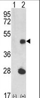 Luc7 / LUC7L Antibody - Western blot of LUC7L (arrow) using rabbit polyclonal LUC7L Antibody. 293 cell lysates (2 ug/lane) either nontransfected (Lane 1) or transiently transfected with the LUC7L gene (Lane 2).