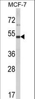 LUC7L2 Antibody - Western blot of LUC7L2 Antibody in MCF-7 cell line lysates (35 ug/lane). LUC7L2 (arrow) was detected using the purified antibody.