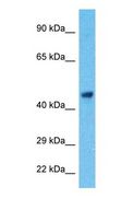 LUC7L2 Antibody - Western blot of LC7L2 Antibody with human HeLa Whole Cell lysate.  This image was taken for the unconjugated form of this product. Other forms have not been tested.