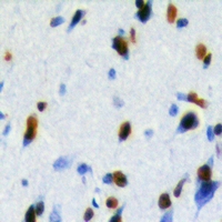 LUC7L2 Antibody - Immunohistochemical analysis of LUC7L2 staining in human brain formalin fixed paraffin embedded tissue section. The section was pre-treated using heat mediated antigen retrieval with sodium citrate buffer (pH 6.0). The section was then incubated with the antibody at room temperature and detected with HRP and DAB as chromogen. The section was then counterstained with hematoxylin and mounted with DPX.